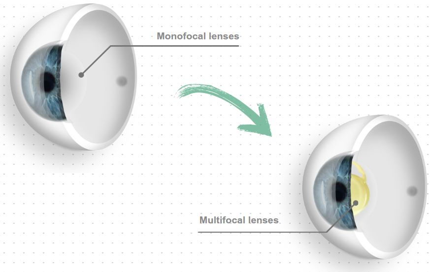 Augenarzt Frankfurt Professor Mehdi Shajari in OP-Kleidung vor dem Augenlaser beim operieren