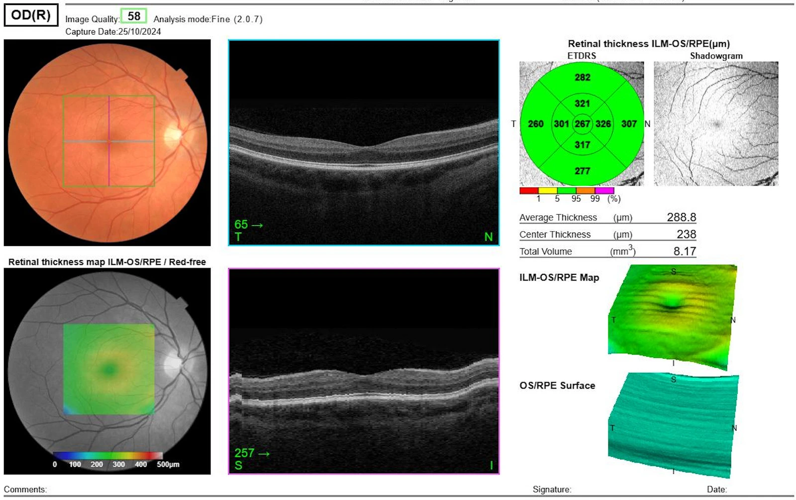 feinschicht-aufnahme