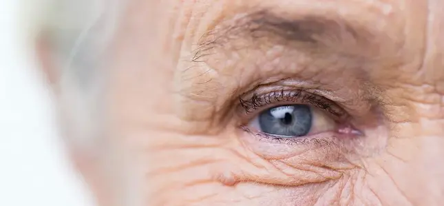 Patient mit Symptomen einer Glaskörpertrübung