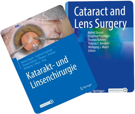 Katarakt- und Linsenchirurgie Buch Cover