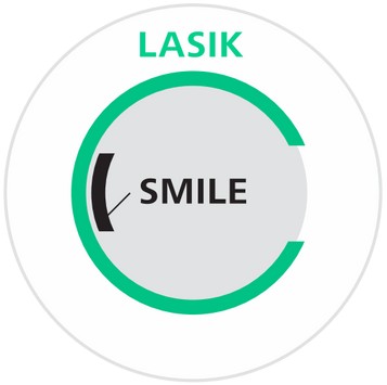 Vergleich des Schnitts bei SMILE PRO vs. LASIK