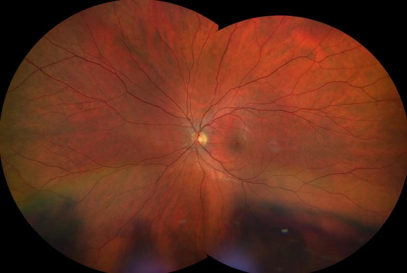 Neueste Ultrawide-Aufnahme bei enger Pupille