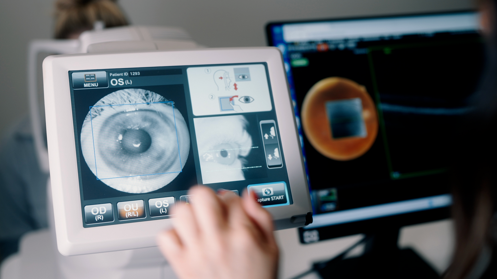 Vergleich Patient mit Glaukom früh diagnostiziert vs. Patient mit Glaukom spät diagnostiziert